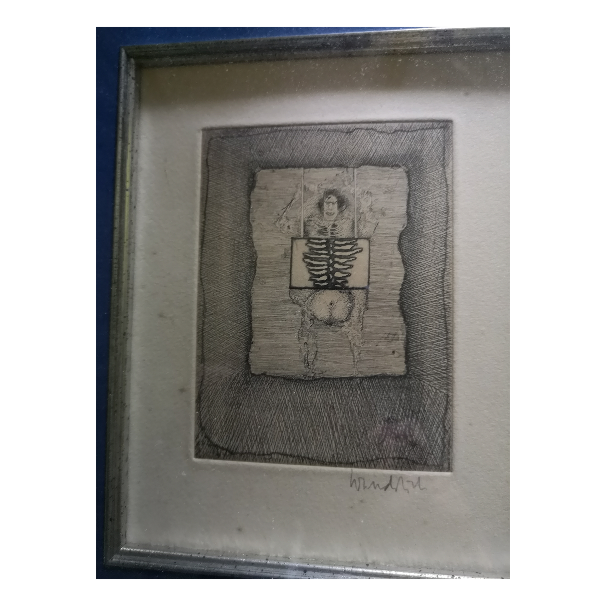 Radiographie eau-forte Paul Wunderlich illustration surréaliste art contemporain graphique
