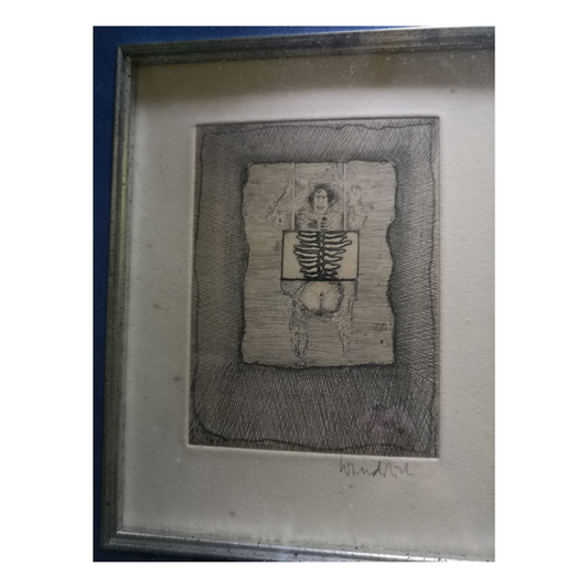 Radiographie eau-forte Paul Wunderlich illustration surréaliste art contemporain graphique
